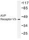 Arginine Vasopressin Receptor 1B antibody, AP01341PU-N, Origene, Western Blot image 