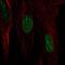 HSPB7 antibody, NBP1-84334, Novus Biologicals, Immunofluorescence image 