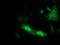 Proteasome Inhibitor Subunit 1 antibody, LS-C337834, Lifespan Biosciences, Immunofluorescence image 