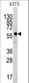 Kringle Containing Transmembrane Protein 1 antibody, LS-C100231, Lifespan Biosciences, Western Blot image 