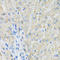 RFC1 antibody, LS-C749636, Lifespan Biosciences, Immunohistochemistry paraffin image 