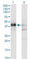 Serine And Arginine Rich Splicing Factor 5 antibody, H00006430-M03A, Novus Biologicals, Western Blot image 