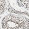 TATA-Box Binding Protein Associated Factor 6 antibody, HPA006566, Atlas Antibodies, Immunohistochemistry frozen image 