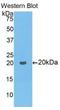 Collagen Type VIII Alpha 1 Chain antibody, LS-C301236, Lifespan Biosciences, Western Blot image 