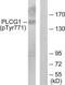 Phospholipase C Gamma 1 antibody, LS-C199474, Lifespan Biosciences, Western Blot image 