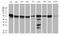 Chaperonin Containing TCP1 Subunit 4 antibody, M07708, Boster Biological Technology, Western Blot image 