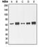 Matrix Metallopeptidase 14 antibody, orb214264, Biorbyt, Western Blot image 