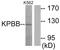 Phosphorylase Kinase Regulatory Subunit Beta antibody, LS-C119198, Lifespan Biosciences, Western Blot image 