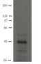 SLC9A3 Regulator 2 antibody, MA5-18083, Invitrogen Antibodies, Western Blot image 