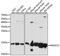 NADH:Ubiquinone Oxidoreductase Subunit C2 antibody, GTX35226, GeneTex, Western Blot image 