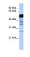 RAD18 E3 Ubiquitin Protein Ligase antibody, orb330292, Biorbyt, Western Blot image 