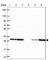 Tumor protein D52 antibody, HPA062167, Atlas Antibodies, Western Blot image 