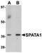 Spermatogenesis Associated 1 antibody, orb75682, Biorbyt, Western Blot image 