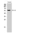 Vacuolar fusion protein CCZ1 homolog B antibody, A15204, Boster Biological Technology, Western Blot image 