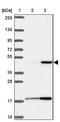 Acid Phosphatase, Prostate antibody, NBP2-39012, Novus Biologicals, Western Blot image 