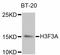 H3 Histone Family Member 3B antibody, abx125337, Abbexa, Western Blot image 