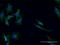 Glutamic--Pyruvic Transaminase 2 antibody, H00084706-M04, Novus Biologicals, Immunofluorescence image 