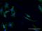 Alanine aminotransferase 2 antibody, H00084706-M04, Novus Biologicals, Immunofluorescence image 