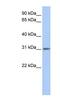 Outer Dense Fiber Of Sperm Tails 3 Like 1 antibody, NBP1-56392, Novus Biologicals, Western Blot image 