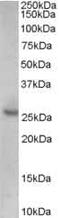 Cyclin Dependent Kinase Inhibitor 1B antibody, PA5-18480, Invitrogen Antibodies, Western Blot image 