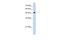 Septin 6 antibody, A10957, Boster Biological Technology, Western Blot image 
