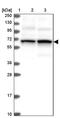 Trichoplein Keratin Filament Binding antibody, PA5-58475, Invitrogen Antibodies, Western Blot image 