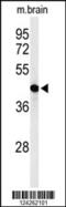 Glycerol-3-phosphate acyltransferase 4 antibody, 64-047, ProSci, Western Blot image 