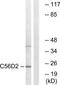 Cytochrome B561 Family Member D2 antibody, TA312780, Origene, Western Blot image 