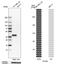 FXYD Domain Containing Ion Transport Regulator 5 antibody, HPA010817, Atlas Antibodies, Western Blot image 