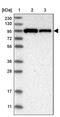 VPS53 Subunit Of GARP Complex antibody, PA5-55079, Invitrogen Antibodies, Western Blot image 