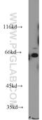 WEE1B antibody, 55119-1-AP, Proteintech Group, Western Blot image 