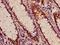 Acylaminoacyl-Peptide Hydrolase antibody, CSB-PA001899LA01HU, Cusabio, Immunohistochemistry paraffin image 