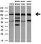 cGMP-dependent 3 ,5 -cyclic phosphodiesterase antibody, M03472, Boster Biological Technology, Western Blot image 