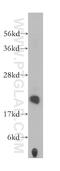 Phosphomevalonate Kinase antibody, 15674-1-AP, Proteintech Group, Western Blot image 