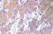 p65 antibody, AP21046PU-N, Origene, Immunohistochemistry frozen image 