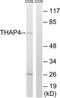 THAP Domain Containing 4 antibody, TA315443, Origene, Western Blot image 