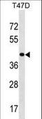 Homeobox D8 antibody, LS-C159867, Lifespan Biosciences, Western Blot image 