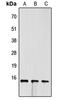 Fatty Acid Binding Protein 4 antibody, abx121601, Abbexa, Western Blot image 