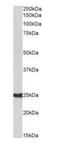 HDGF Like 3 antibody, orb318752, Biorbyt, Western Blot image 