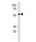 RUNX Family Transcription Factor 2 antibody, F50727-0.4ML, NSJ Bioreagents, Immunohistochemistry paraffin image 