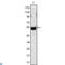 Fibrinogen Beta Chain antibody, LS-C814013, Lifespan Biosciences, Western Blot image 