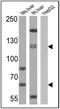 Sterol Regulatory Element Binding Transcription Factor 1 antibody, NB100-74542, Novus Biologicals, Western Blot image 