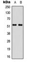 STEAP4 Metalloreductase antibody, LS-C368531, Lifespan Biosciences, Western Blot image 