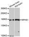 NPHS1 Adhesion Molecule, Nephrin antibody, A12467, ABclonal Technology, Western Blot image 