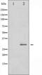 Snail Family Transcriptional Repressor 1 antibody, TA325860, Origene, Western Blot image 