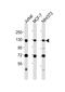 DNA replication licensing factor MCM2 antibody, MBS9206182, MyBioSource, Western Blot image 