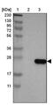 Tetraspanin 1 antibody, NBP2-33867, Novus Biologicals, Western Blot image 