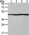 Ubiquinol-Cytochrome C Reductase Core Protein 2 antibody, PA5-51152, Invitrogen Antibodies, Western Blot image 