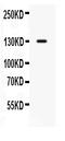 CUB Domain Containing Protein 1 antibody, PB9933, Boster Biological Technology, Western Blot image 