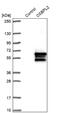 Oxysterol Binding Protein Like 2 antibody, NBP1-92237, Novus Biologicals, Western Blot image 